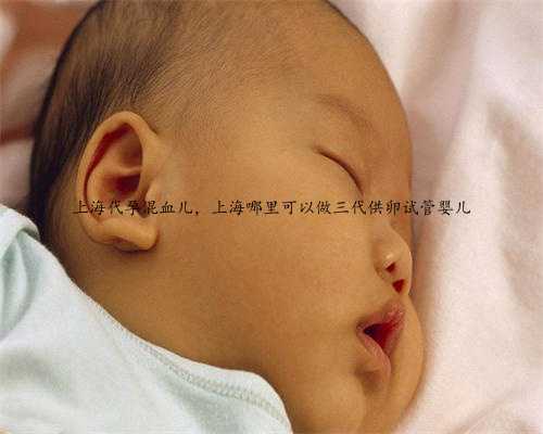 上海代孕混血儿，上海哪里可以做三代供卵试管婴儿