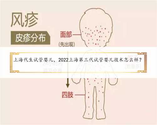 上海代生试管婴儿，2022上海第三代试管婴儿技术怎么样？