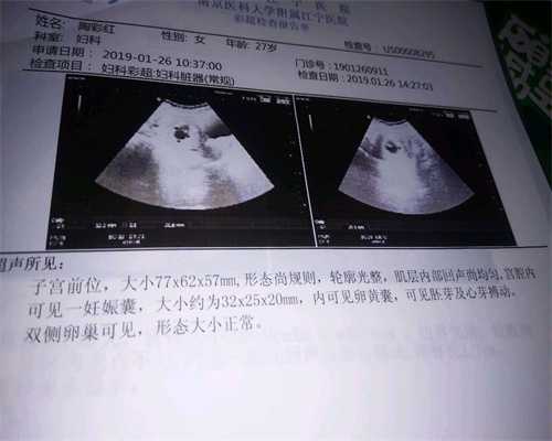 武汉代孕网报酬怀代孕后，婆婆要我回老家养胎