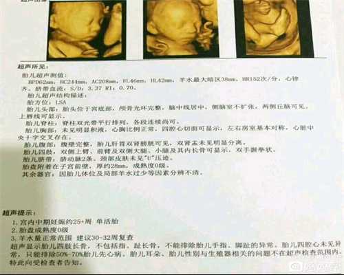 武汉正规代孕医院代孕胎儿畸形很多是“吃”出