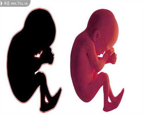 武汉代孕妻子的双胞胎,宫外孕手术后导致的气血