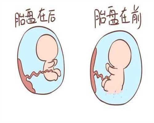 反对武汉代孕的原因,大部分女性都有盆腔积液