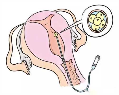 关于自测输卵管堵塞，哪些方法比较准确