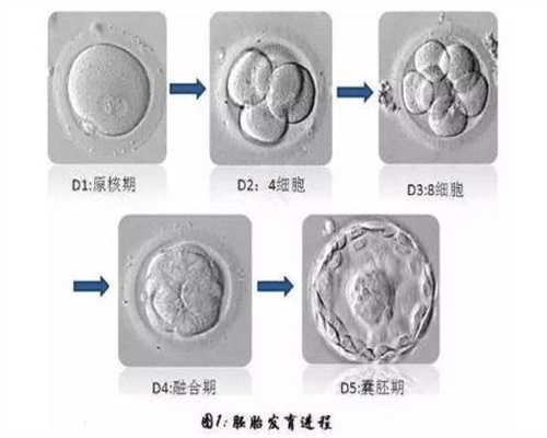中国武汉代孕公司,久备不孕，这5项检查你做了吗