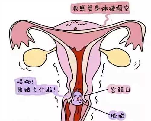 输卵管通而不畅还可能怀孕吗