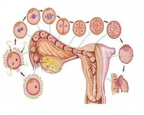 辅生医学科普子宫内膜异位的症状有哪些