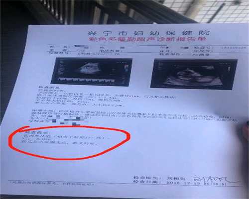 泰国武汉代孕小孩如何回国,为什么孕妇肚脐有凸