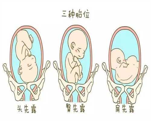 武汉俄罗斯代孕优势_武汉代孕风险有哪几项对胎