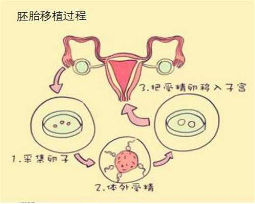 武汉环球代孕,武汉代孕套餐有哪些性高潮对受孕