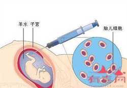 上海绝经后可以借卵生子吗，孕妇贫血缺氧怎么治疗